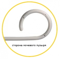 Сторона мочевого пузыря